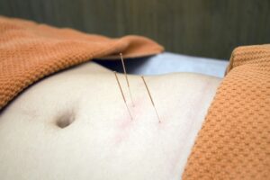 Can acupuncture help back pain?